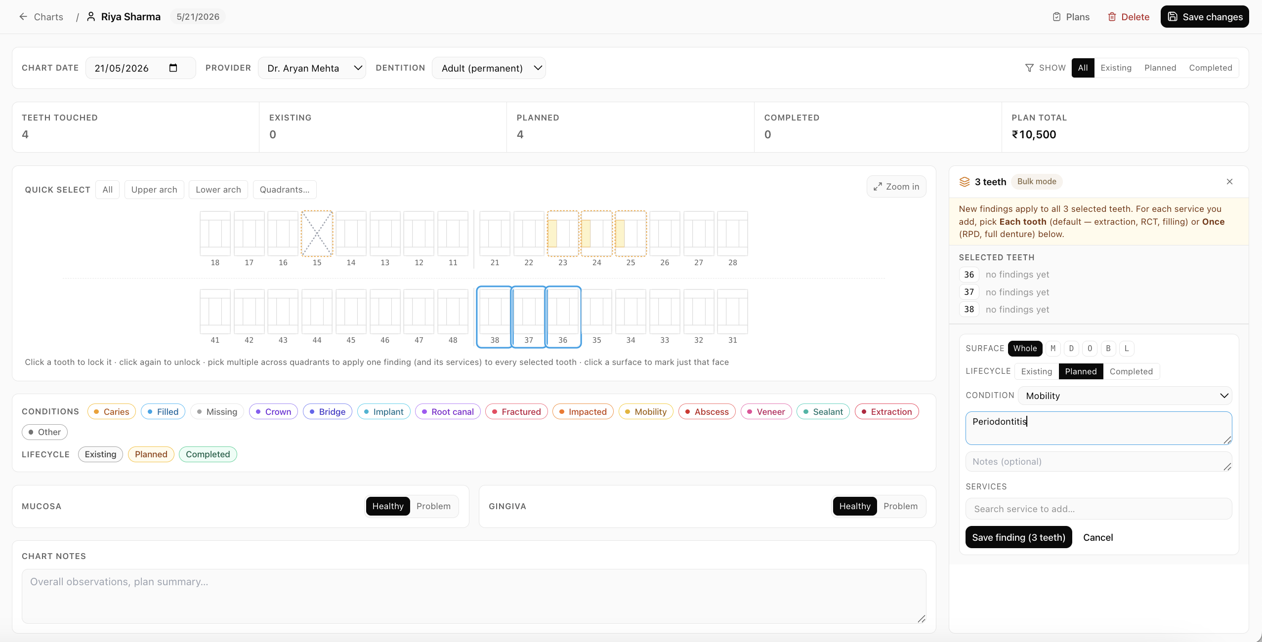 Xodont dental charting screen with an interactive tooth chart and clinical findings.